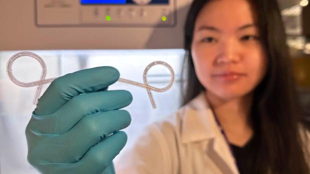 NYU's 3D-Printed Lily Stent Targets Gastric Leaks After Weight-Loss Surgery