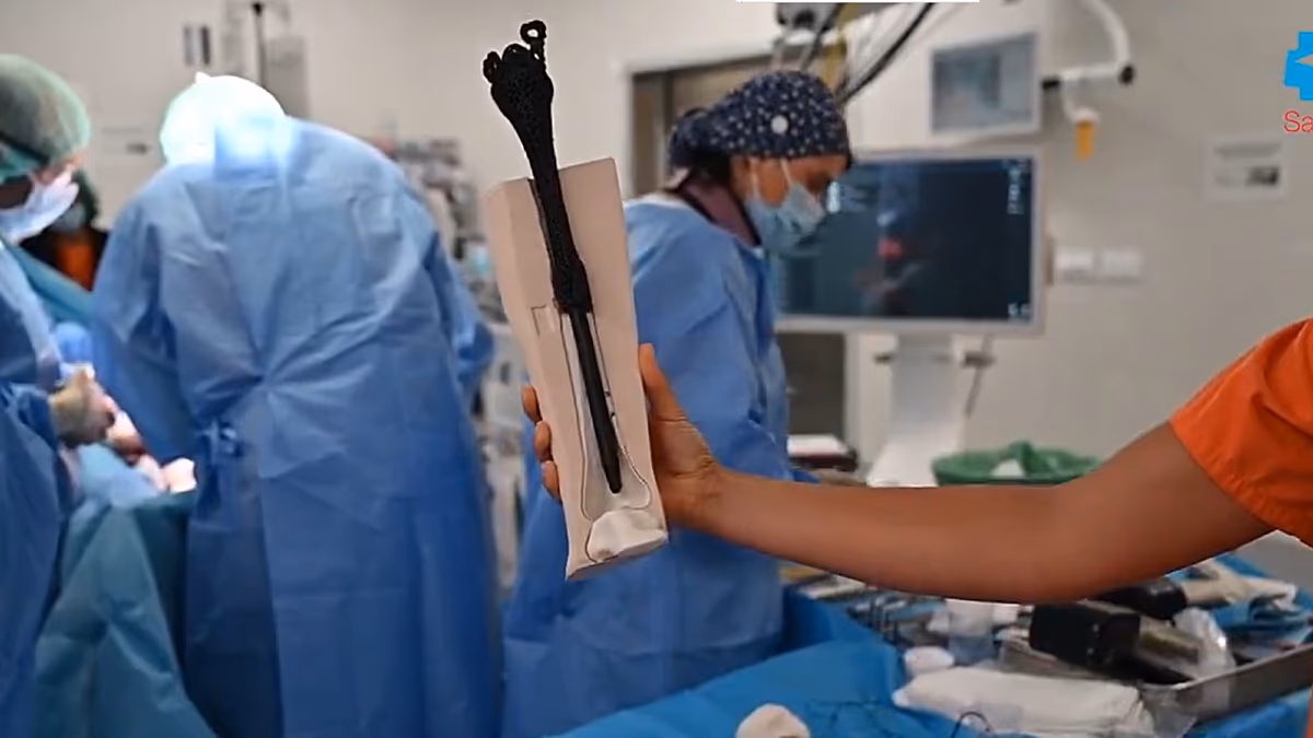 Madrid Hospital Saves a Patient's Leg With the World's First 3D-Printed Metamaterial Bone Implant