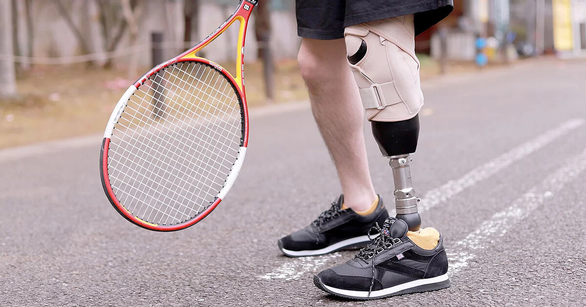 NX Group Backs Instalimb 3D-Printed Prosthetics Maker With Series C Investment