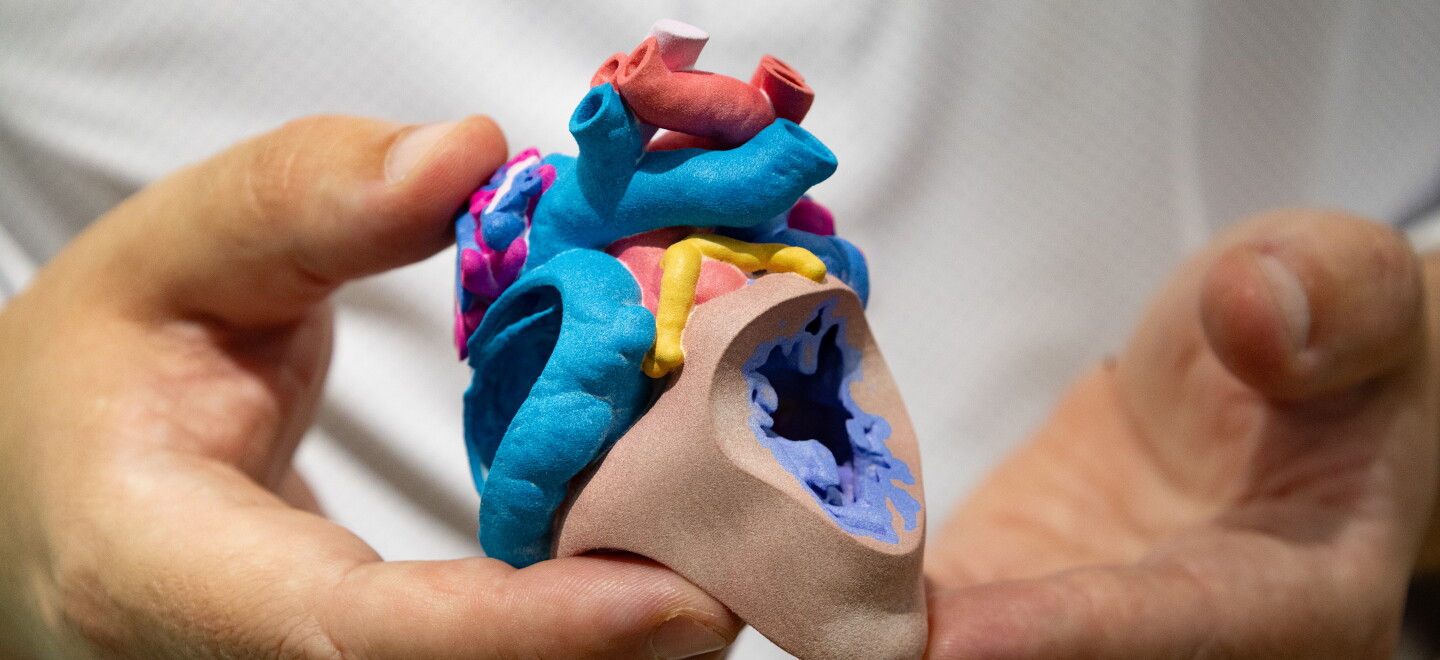 How Rady Children's 3D Lab Is Changing Pediatric Surgery