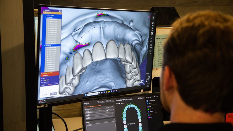 22-Year-Old Engineer 3D Prints Free Dentures for Those Who Cant Afford Them